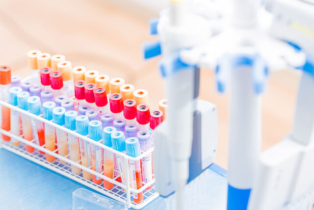 Emergency lab services in Houston Emergency lab services in Houston