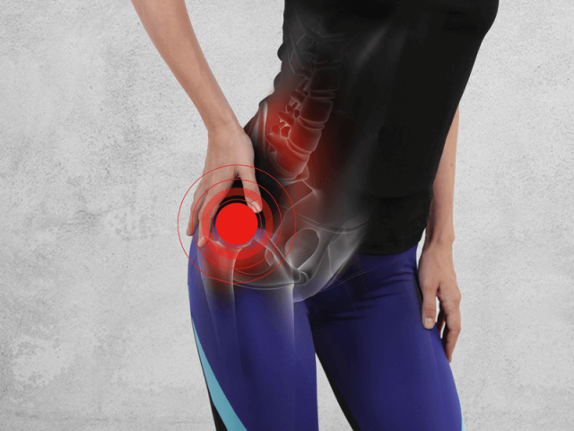 Hip Joint Dislocation: Causes, Types, and Treatment Options